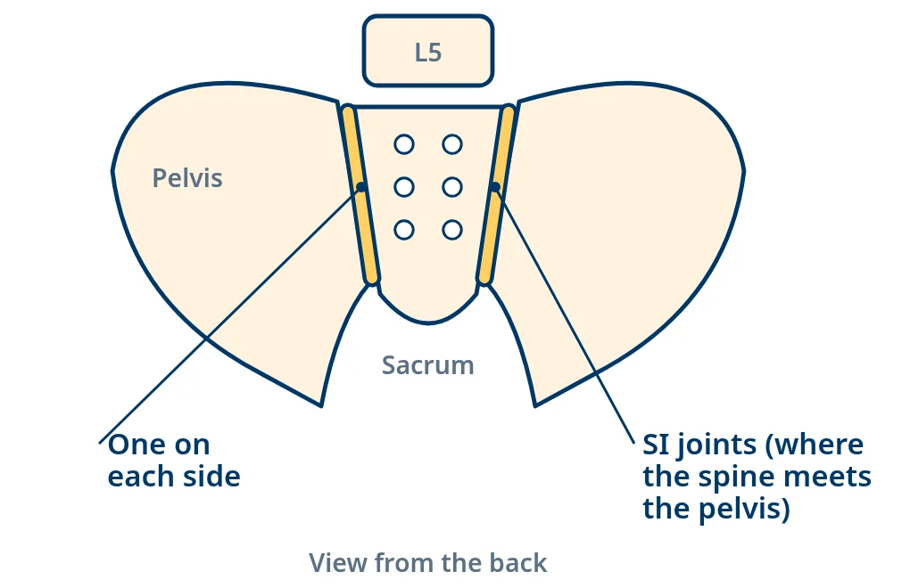 Back view of the pelvis and sacrum with the two SI joints highlighted, where the base of the spine meets the pelvis.
